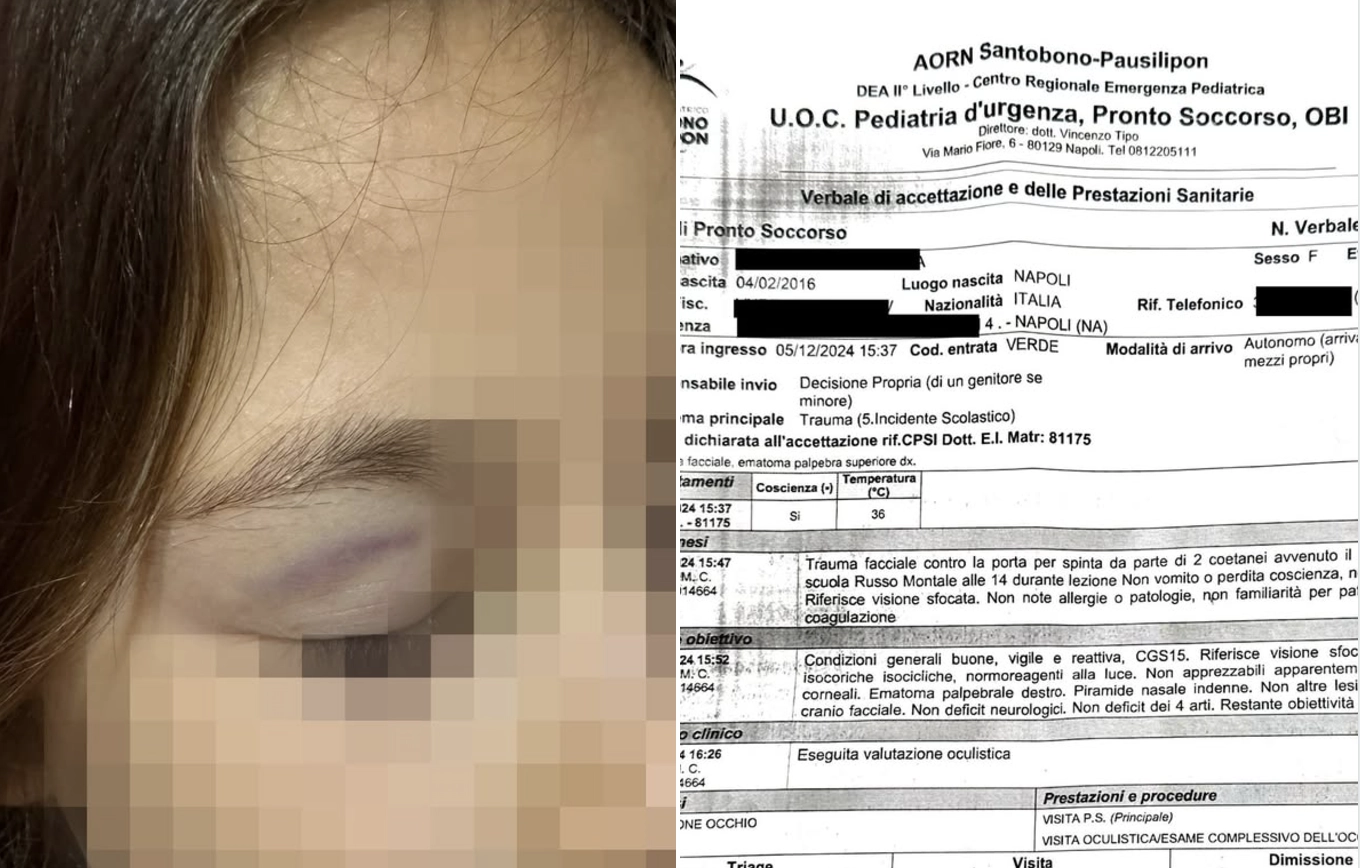 Napoli, aggredita a scuola dai bulli: la bimba ha solo 8 anni. Ricoverata a Santobono